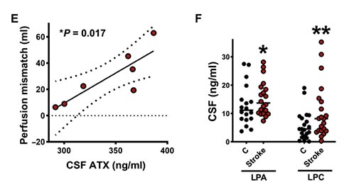 抑制星胶释放的ATX可降低卒中后兴奋性毒性并改善预后