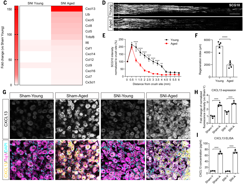 在衰老DRG中，神经元CXCL13和CXCR5+ CD8+ T细胞显著升高
