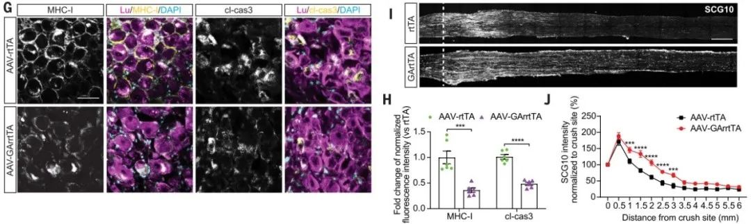SNI后衰老相关的神经再生衰退依赖于CD8+ T细胞和神经元MHC I的表达2