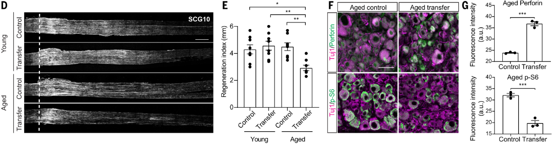 CXCR5+ CD8+ T细胞驱动SNI后衰老依赖的轴突再生衰退2