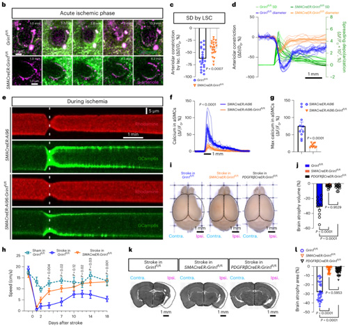 西湖大学贾洁敏团队揭示神经元和脑血管的直接对话机制