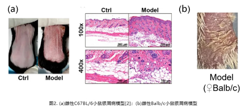 IMQ诱导小鼠银屑病模型
