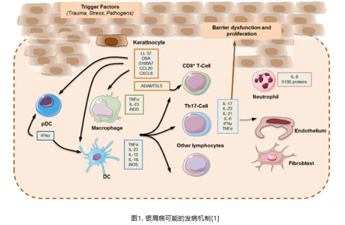 IMQ诱导小鼠银屑病模型