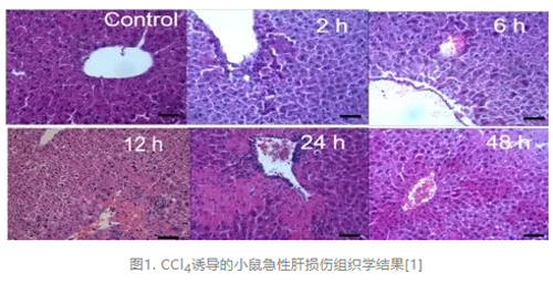 瑞沃德病理切片机在四氯化碳诱导小鼠肝损伤模型中的应用