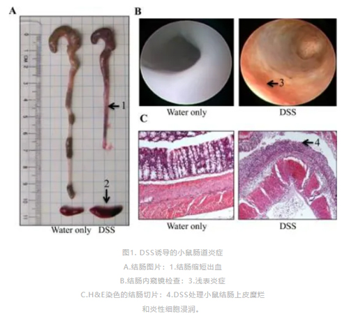 瑞沃德病理切片机在炎症性肠病（IBD）模型中的应用