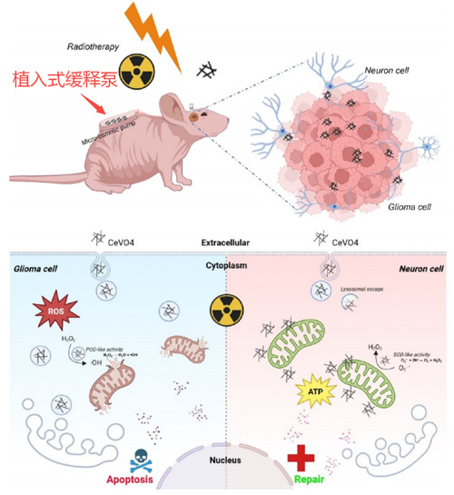 山东大学齐鲁医院薛皓、李刚团队为胶质母细胞瘤放射治疗后脑损伤的修复提供新思路